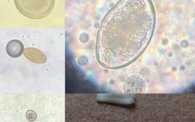 Badanie kału i pasożytów wewnętrznych